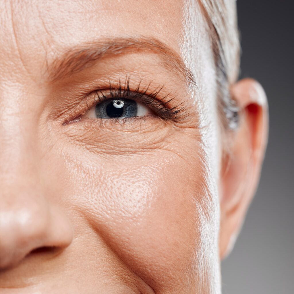 Effective Anti-Wrinkle Treatments in Colliers Wood | Dr Shona